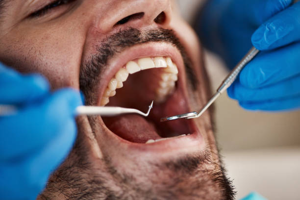 Best Emergency Treatment for Toothache in East Village, CT